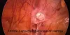 Best Surgeon for Hernia Repair in Gurgaon