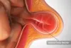 Best Laparoscopic Hernia Surgeon in Delhi NCR, India