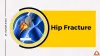 Hip Fracture: Understand Symptoms, Types, Treatment - Best Joint Replacement Surgeon in Pune Maharashtra