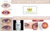 Uveitis Natural Remedies | Symptoms Causes and Natural Home Treatment - Herbal Care Products
