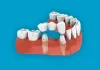 Dr.Lavanya Dental Clinic | Best Dental Clinic in Madhapur
