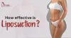 How effective is liposuction?