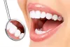 Advantages of Dental Veneers from Tower House Dental Clinic