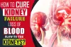 How To Cure Kidney Failure Caused By Loss Of Blood Flow To The Kidneys?