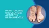 How To Cure Rheumatoid Arthritis Permanently? - Dr Sartawi