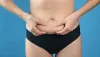 How To Know If You Have Diastasis Recti After Pregnancy? - Dr. Daniel Serralta
