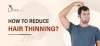 How to Reduce Hair thinning? - Dr. Amit Gupta
