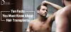 Ten Facts You Must Know about Hair Transplants