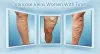 Do Spider Veins Cause Soreness?  