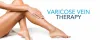 DETAILED PROCEDURE OF VEIN TREATMENT YOU NEED TO KNOW NOW! -