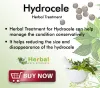 Hydrocele Treatment WithOut Surgery | Herbal Care Products - Herbal Care Products