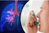 Chest Physician in Aurangabad- Subhashree Hospital