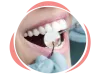 Smile Makeover in Sydney, Windsor, Kurrajong, Masdan Park, Bligh Park