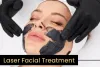 Know All About Laser Skincare Clinic - Concerns, Products, and Treatments - You By Sia