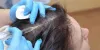 Hair Club Pakistan