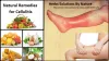 Natural Remedies for Cellulitis Treat with Natural Essential Oils - Dubai Entertainment