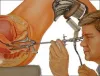 operative hysteroscopy treatment delhi