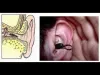 What Happens If A Centipede Enters Your Ear?