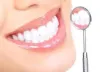 Express Yourself With That Flawless Smile!! |