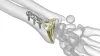 Orthopaedic Implants Exporter - Orthopedic and Trauma Implants Blog