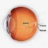 Best Retina Hospital In Mumbai, Retina Surgery In Mumbai, Retina Treatment In India