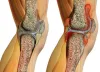  Best Rheumatology Clinics in Hyderabad