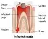 Impact Dental Care Gives Advance Dental Care