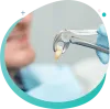 Wisdom Teeth Removal Calgary | Wisdom Teeth Extraction Calgary