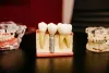 Full Dentures Implants in Hawaii