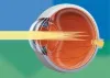 Dr. LEO Ayzenberg, MD The Best Cataract Surgery doctor in Chicago