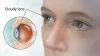 Are you looking best Cataract surgeons in Chicago IL? - teemey