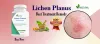 Innovative Lichen Planus Therapeutics