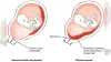 Internal OS Closed: What Does It Mean in Pregnancy Scan Report &ndash; PregaJunction