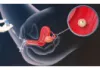 best iui treatment in delhi