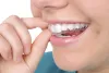 Orthodontic experts are providing you the best quality of treatment in Colorado springs with highly qualified and fully experienced staff.