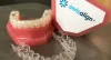 Dental Clinic in Mumbai