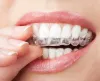 Why Cosmetic Dentistry Has Gained Importance In Such A Short Span - Midtown Dental