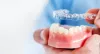 Invisible Braces Cost In Gurgaon