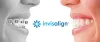 Invisalign | Clear Braces | Clear Aligners | Pure Orthodontics
