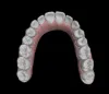 Cheap Invisalign Treatment in Orange County, Invisalign Braces Cost