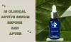 iS Clinical Active Serum before and after - The Trust Blog