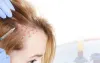 Hair Club
