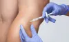 Sclerotherapy - Spider Veins Treatment Denver Thornton - AHVC