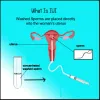 IUI Treatment - Cost of IUI in Delhi - Origyn IVF CenterBest IVF Center in Delhi