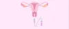 Best IVF Treatment Centres @ Best Cost in Bangkok | Fertility Treatment Clinics and Hospital in Thailand | Medicare Vacation