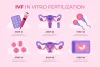 Surrogacy Cost in Delhi