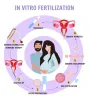 ivf.jpg