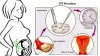 ivf treatment in India