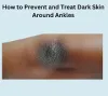 How to Prevent and Treat Dark Skin Around Ankles