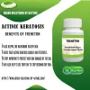 Treneton Actinic Keratosis Treatment at Home Using Natural Ingredients &laquo;  Herbs Solutions by Nature